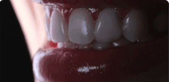 Miniatura do post do blog